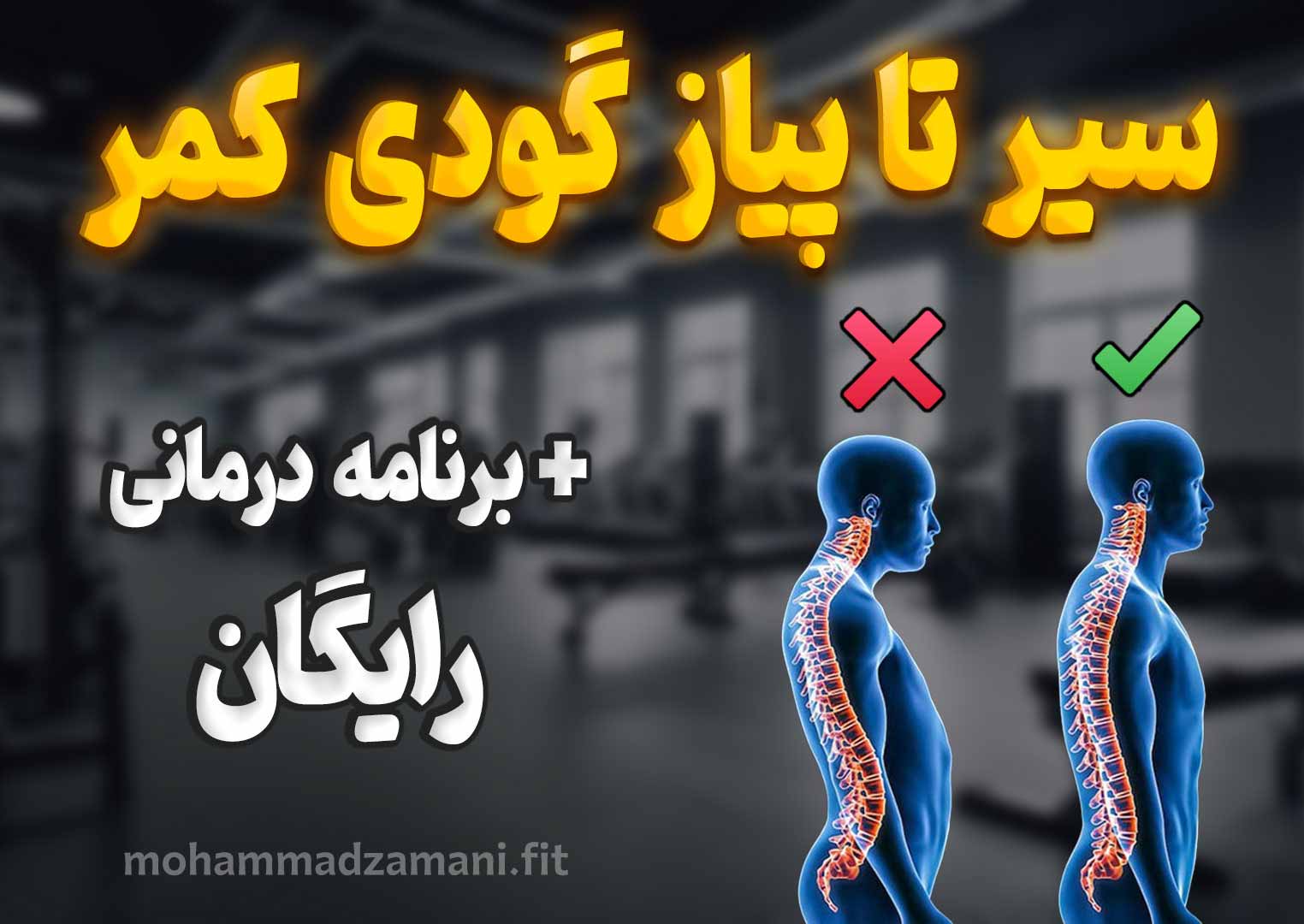 گودی کمر یا لوردوز عارضهای است که انحنای طبیعی کمر بیش از حد معمول باشد و با مشکلاتی مثل درد و ضعف عضلانی همراه است که در این مقاله درمان گودی کمر را آموزش دادهام.